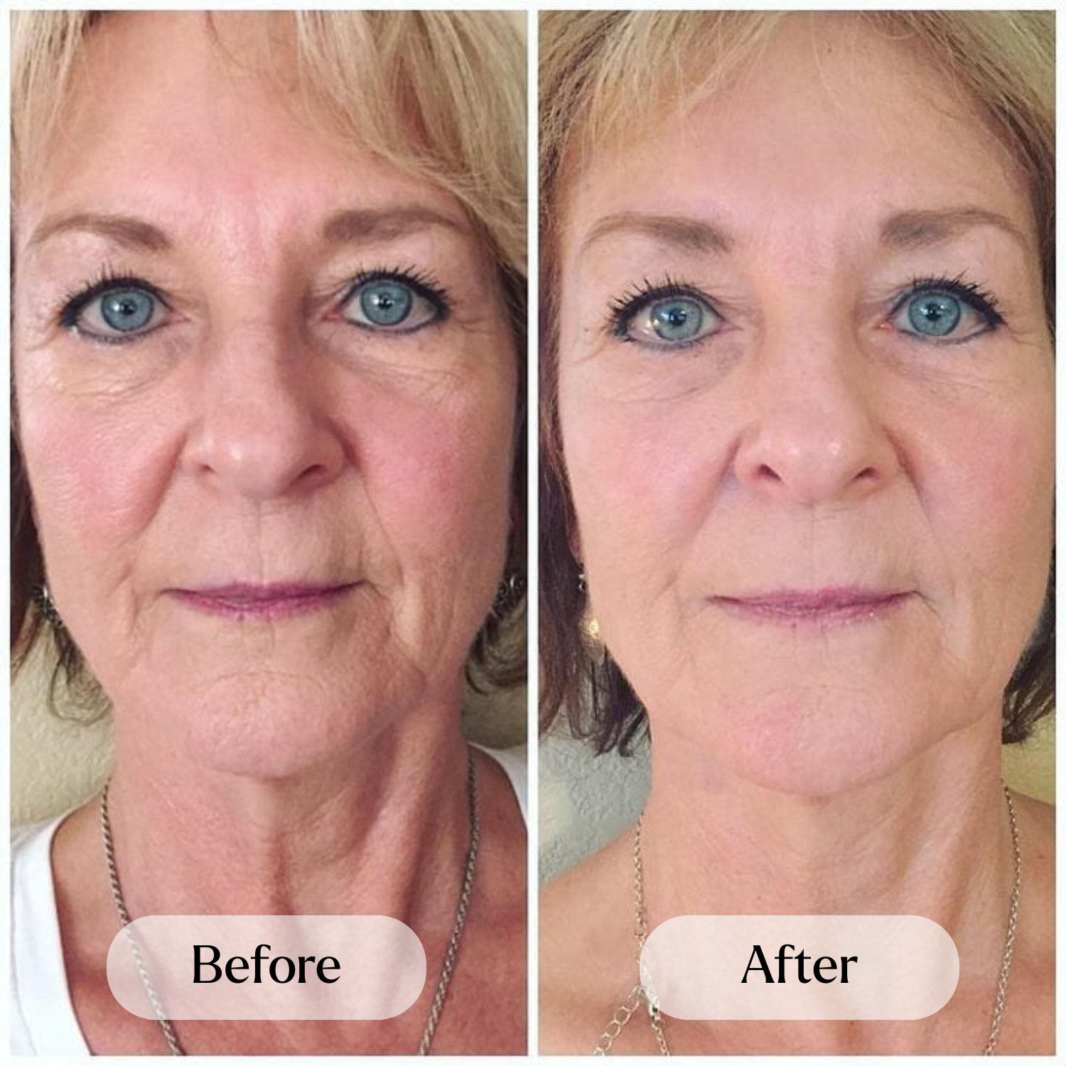 Before and after 7 landing page aquelle.png__PID:68d5434b-86a7-4112-968e-849bf1ebeac2